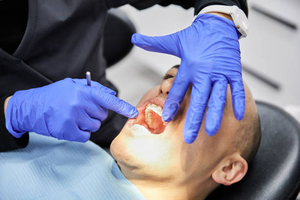 Best Emergency Dental Care for Abscessed Tooth in Dentsville, SC