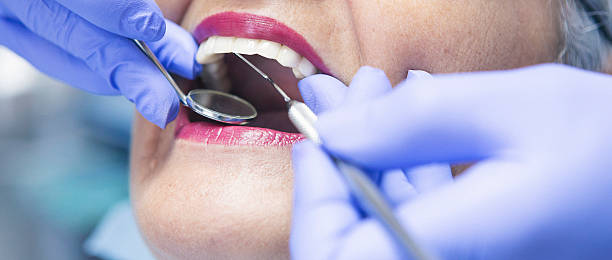 Best Emergency Dentist for Knocked-Out Tooth in Dentsville, SC